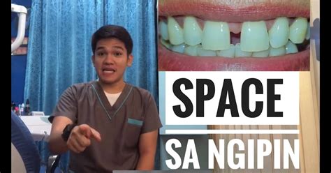 sungki na ngipin in english|sungki in English .